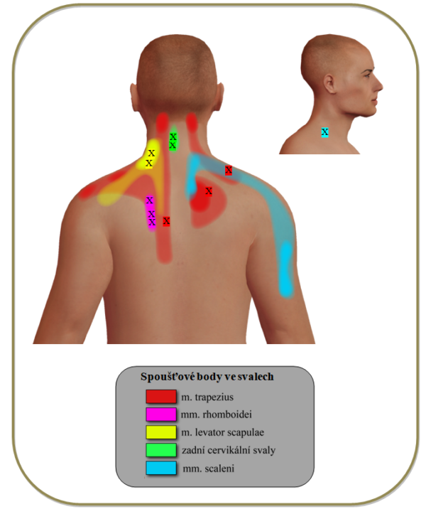 Myofasyciální techniky I – spoušťové body hlava, krk, horní část zad - Image 5