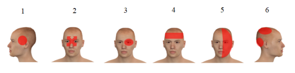 Myofasyciální techniky I – spoušťové body hlava, krk, horní část zad - Image 6