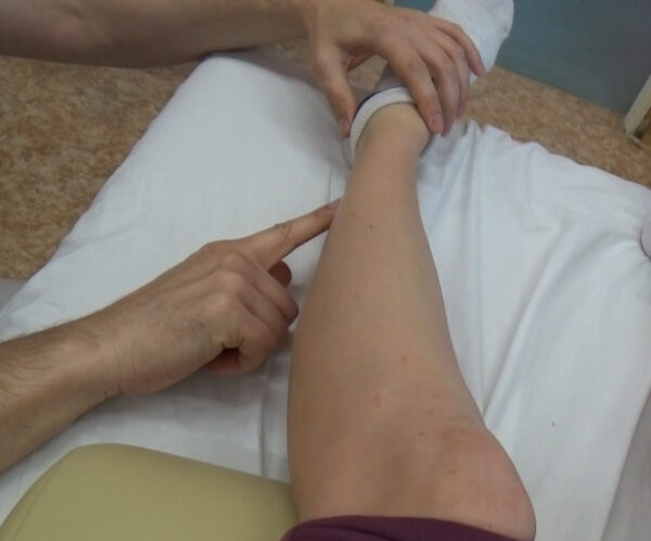 Myofasciálních technik IV – spoušťové body kyčel, koleno, kotník - Image 4