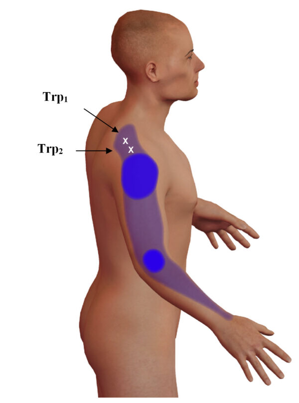 Myofasciální techniky III – spoušťové body rameno a loket - Image 5